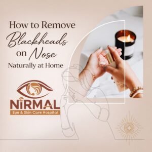 How to Remove Blackheads on Nose Naturally