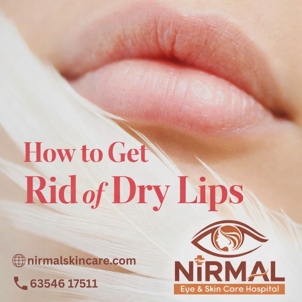How to Get Rid of Dry Lips